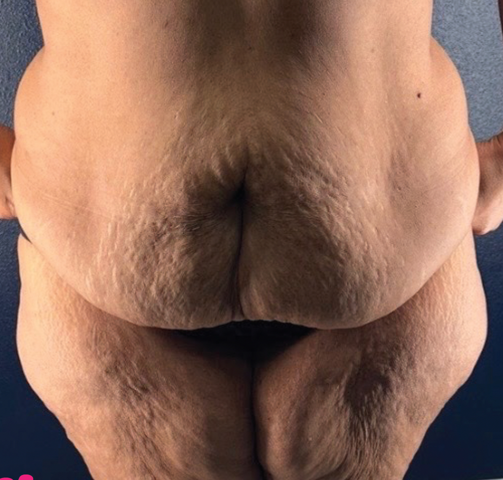 Size 22 to Size 16 in 9 Weeks - before