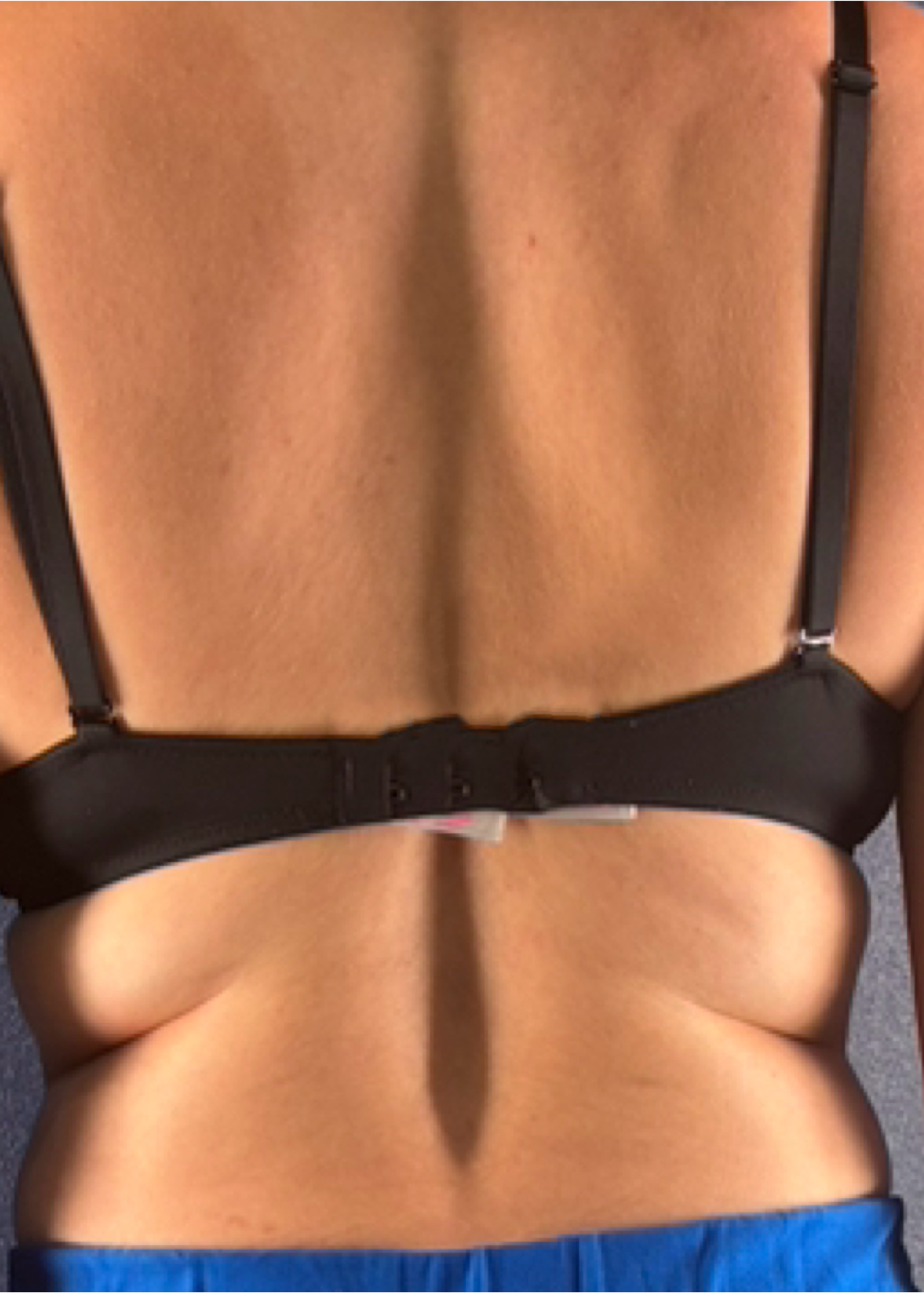 Back Fat? Back Off. - before